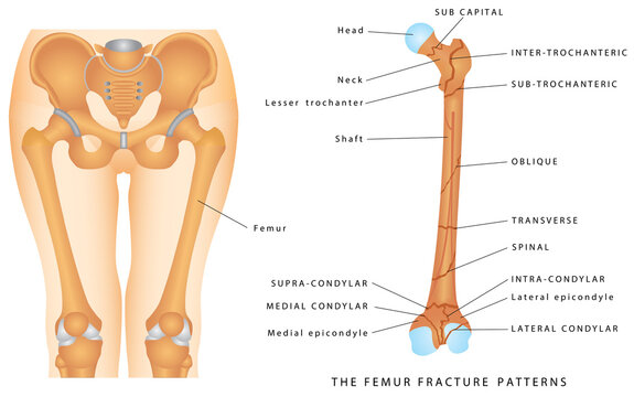 longest bone femur bone