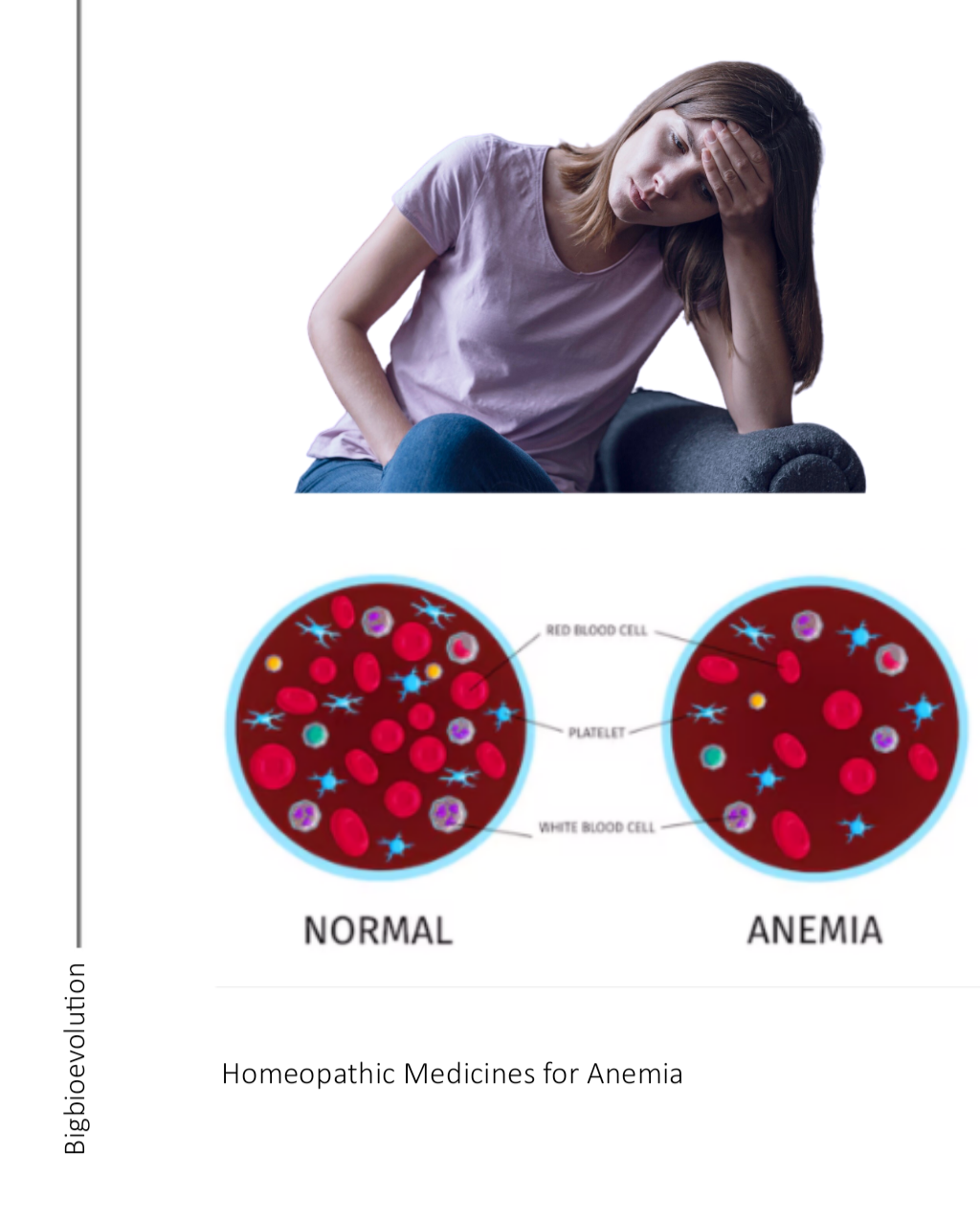 Anemia " homeopathic medicines" picture